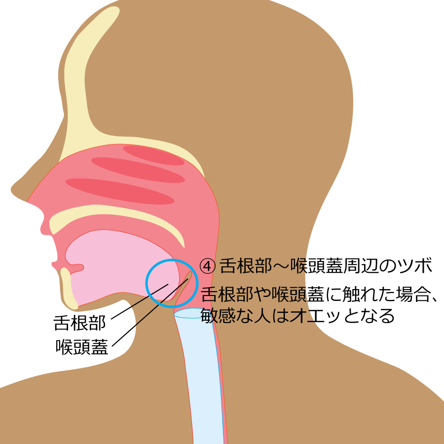 胃カメラ,内視鏡,鼻から,麻酔,鎮静剤,神戸市北区,病院鼻から口から胃カメラ比較